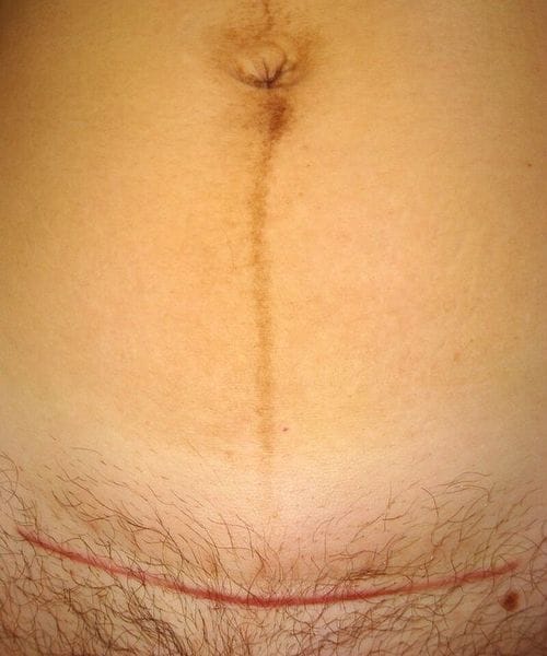 scars-and-the-movement-of-energy-1