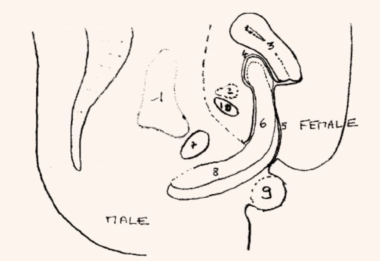 Anatomical cross-section from an MRI study showing the penis positioned in the anterior fornix during intercourse.