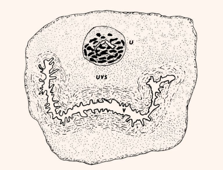 Image 1: Anatomical layout showing the prostate tissue embedded within the urethral wall (U) and its proximity to the vaginal canal (V).