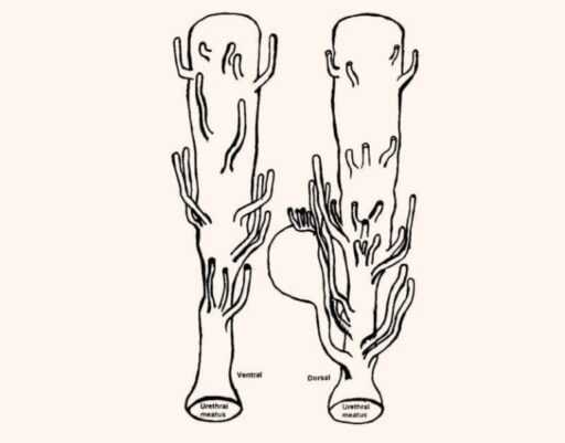 Image 6: Detailed view of multiple paraurethral ducts entering the urethral canal at various points instead of external openings.