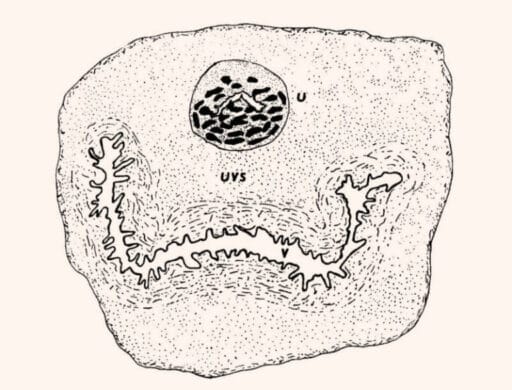 Anatomical layout showing the prostate tissue embedded within the urethral wall (U) and its proximity to the vaginal canal (V).