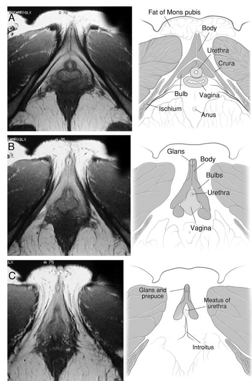 Figure from article of Helen O’Connell in The Journal Of Urology, 2005.